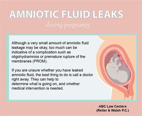 pregnant leaking fluid|Leaking Amniotic Fluid During Pregnancy